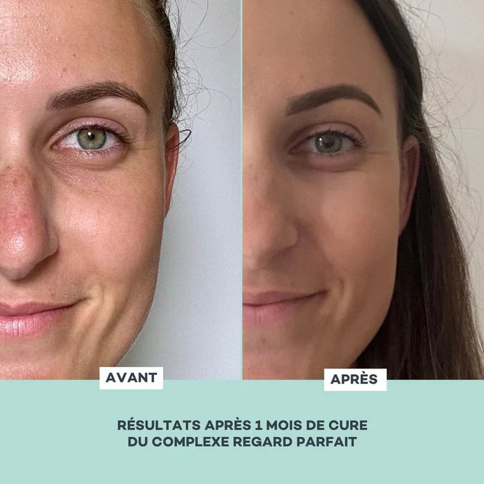 D-LAB Complexe Regard Parfait 1 mois – Anti-cernes, Anti-poches & Anti-rides (Gélules)